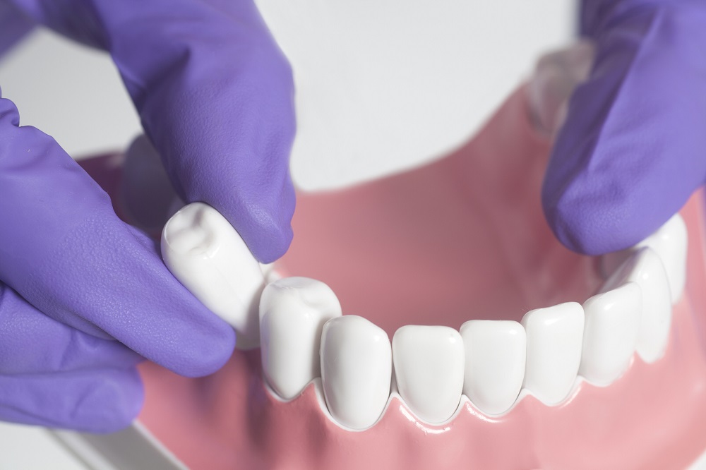 Anatomy Of A Smile Makeover