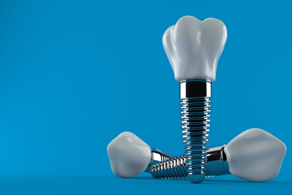 Everything You Need To Know About Dental Implants