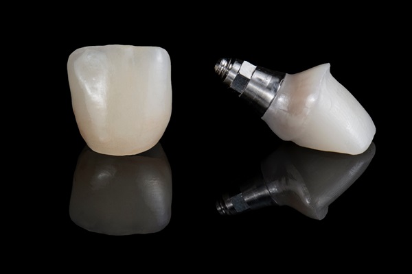 Tips For Implant Crown Care